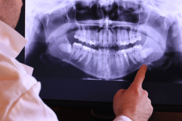Best Walk-In Emergency Dentist in Bonanza, GA