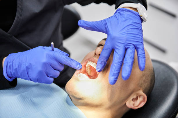 Best Emergency Root Canal Treatment in Bonanza, GA