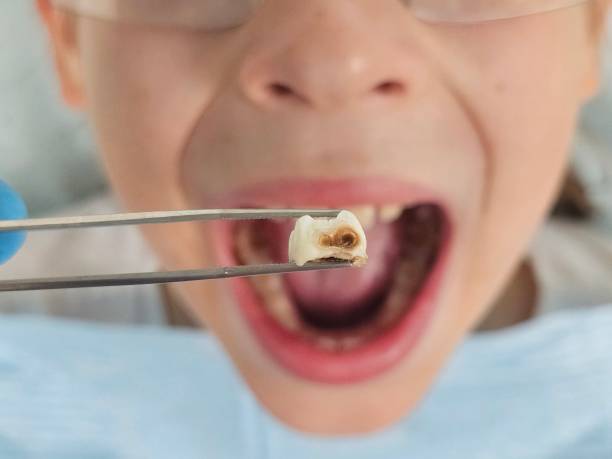Best Emergency Dental Care for Trauma or Injury in Bonanza, GA